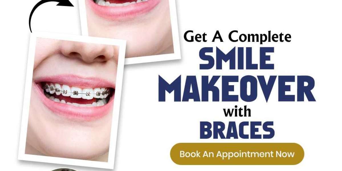 Top-Rated Dentists in Jaipur: Find the Best for Your Smile