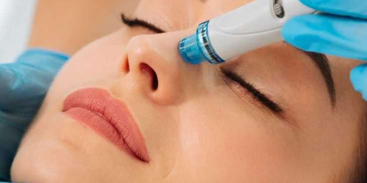 Dermaplaning Facial Chelsea London – Your Complete Guide to Glowing Skin
