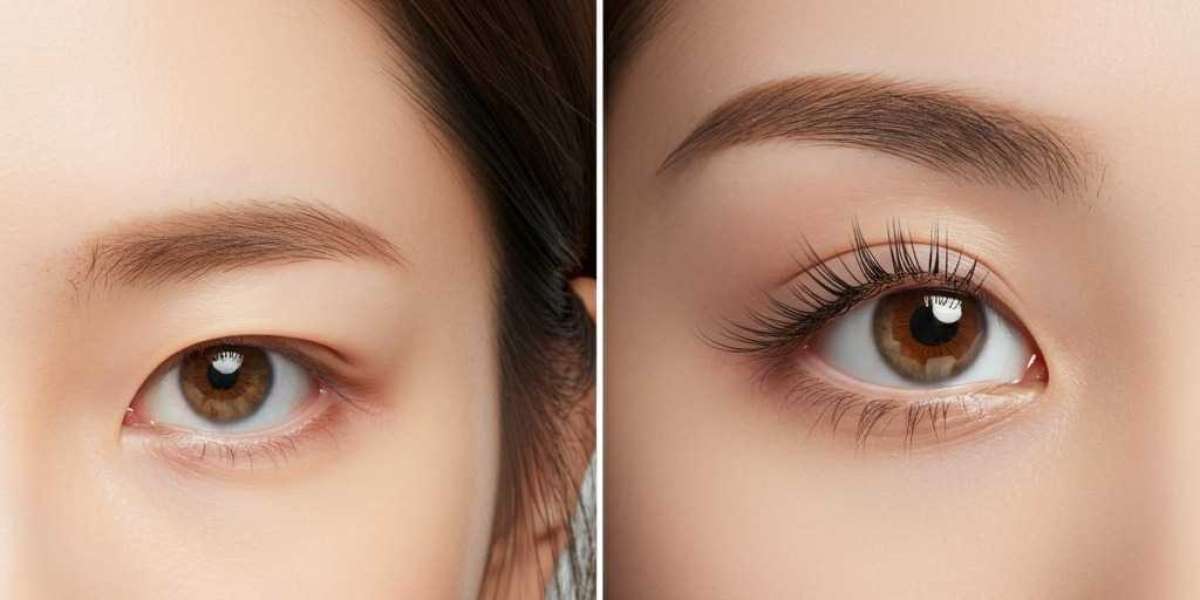 Double Eyelid Surgery: Achieve Beautiful Natural-Looking Eyes
