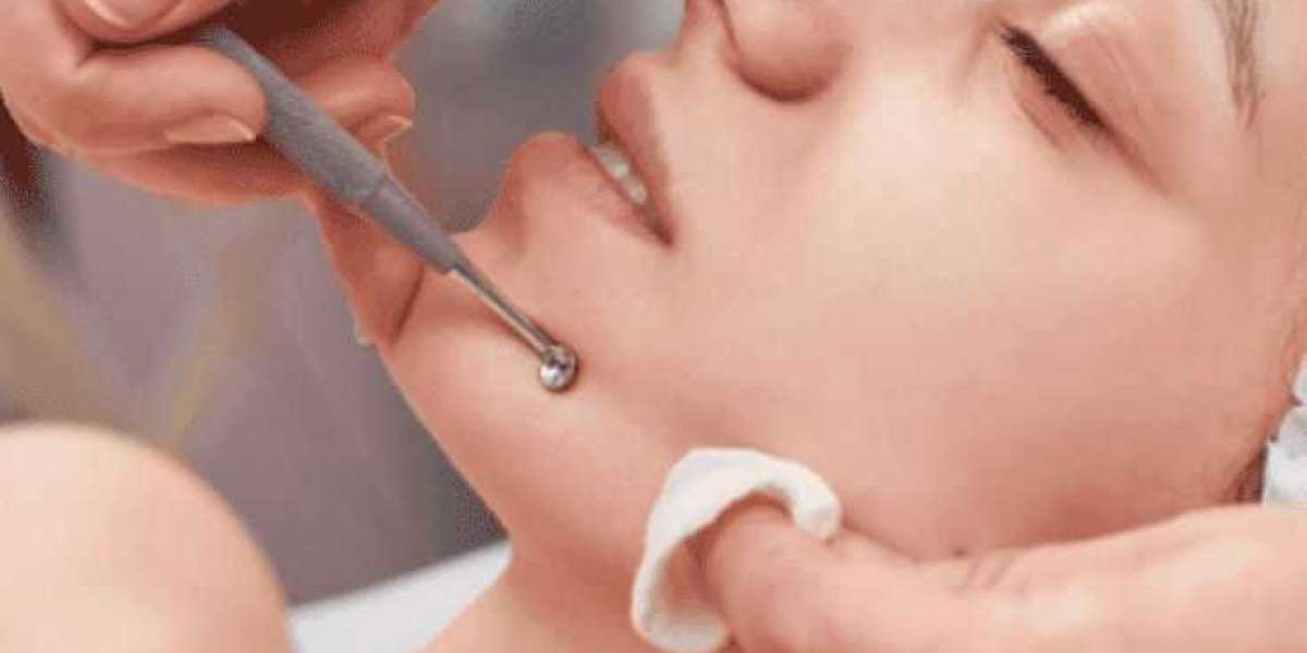 Hydrodermabrasion Facial in Chelsea, London – Reveal Glowing, Hydrated Skin